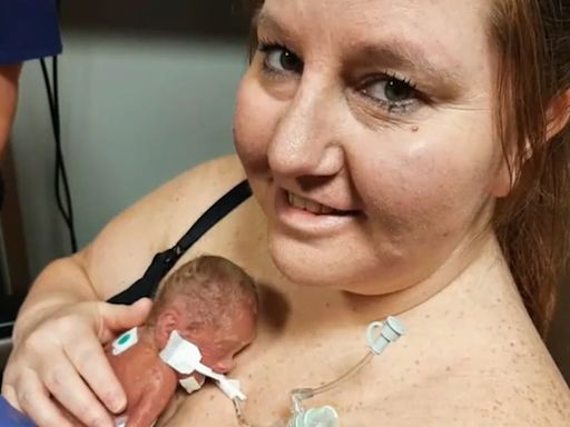 ‘The ultimate miracle’: Baby born at just 13 ounces comes home after 378 days at hospital