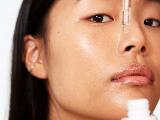 Over Your Melasma? Here's *Exactly* How to Get Rid of It