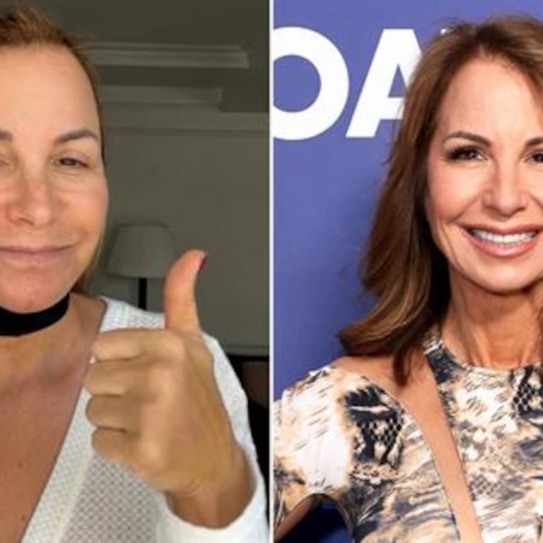 RHONY's Jill Zarin Shows Off Her New Facelift While Still Recovering - E! Online