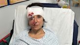 Woman badly injured by cyclist at same spot in London where pensioner was killed