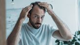 Why modern life is making men lose their hair – and how to prevent it