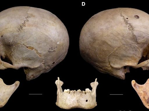 Hallazgo de restos de una cirugía contra el cáncer de hace 4.000 años en Egipto