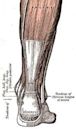 Tendinopathy