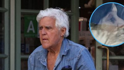 Jay Leno's Wife Spotted With Apparent Black Eye Amid Dementia Battle