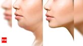 Is jawline correction surgery right choice for you? Expert opinions from Gurgaon doctors | Gurgaon News - Times of India