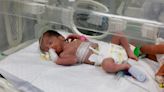 Gaza Baby Rescued From Her Dead Mother’s Womb Dies