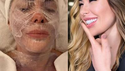 Influenciadora faz tratamento facial à base de cocô de pássaro