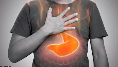 First UK patients get implant to stop acid reflux and heartburn: What does this mean for treatment?