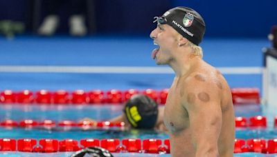 What are the red round marks on the skin of Olympic athletes?