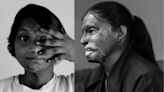 Acid attack survivors share their stories: ‘I’ve spent my whole life not feeling loved’