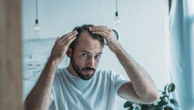 Natural sugar could 'cure' male pattern baldness, scientists suggest