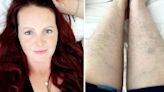Woman shares pros and cons of leg hair, saying it adds 'extra layer of warmth' in winter