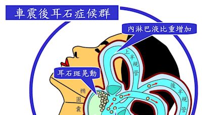 〈耳鳴暈眩保健專欄〉乾柴遇烈火…車震後天天暈