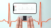 This $99 mini ECG heart monitor gives ‘peace of mind’ — and it has a whopping 52,000 5-star reviews