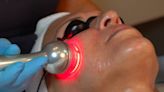 Conoce los grandes beneficios de la radiofrecuencia facial fraccionada