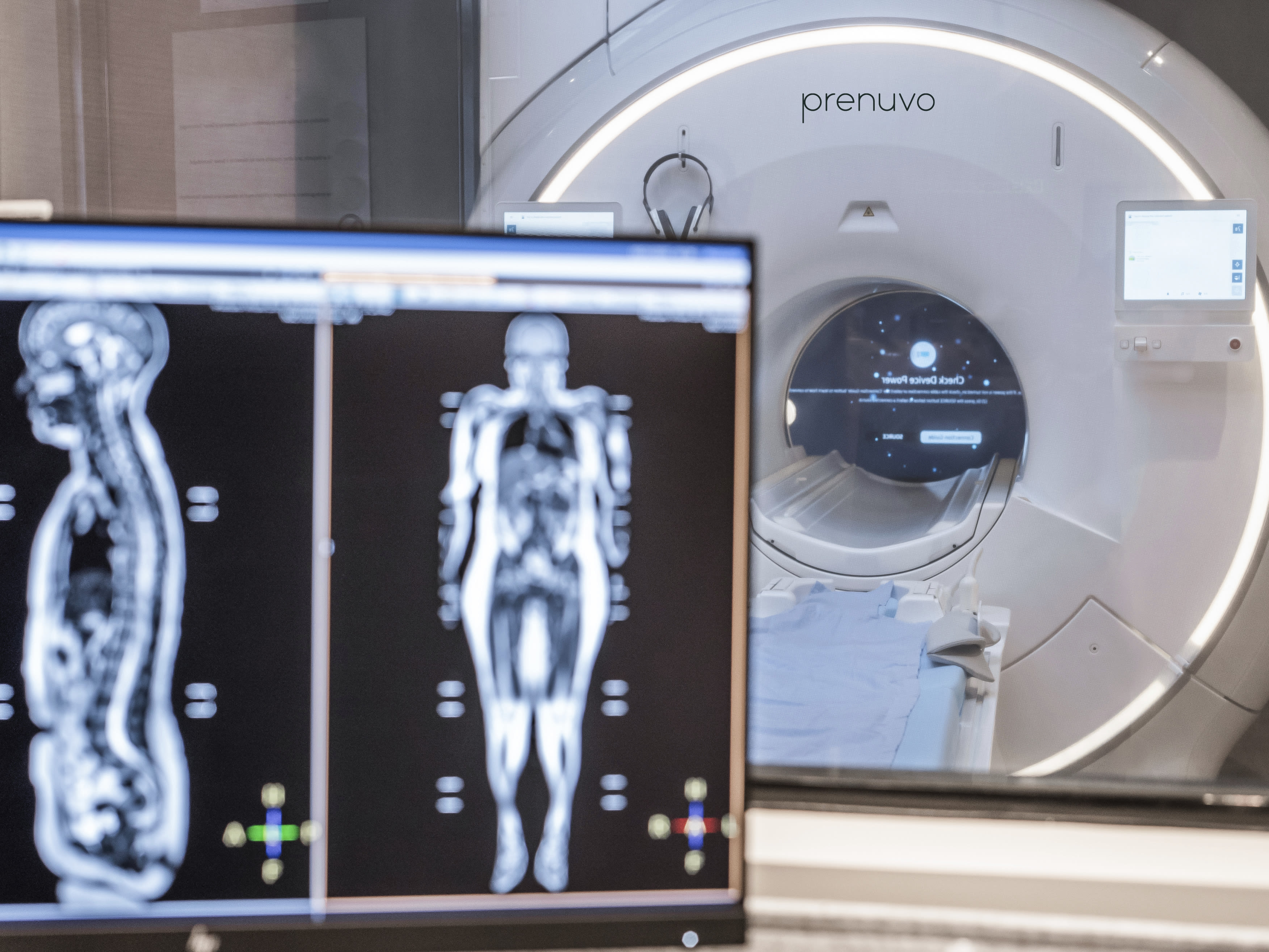 Celebrities are getting $2,000 MRI scans to learn about their health. Should you?