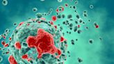 Natera touts positive results for Merkel cell carcinoma surveillance test