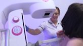 美發布最新乳癌預防指引 建議40歲後婦女每2年篩檢1次