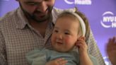 NYU Langone performs jaw surgery to help baby with cleft palate breathe easier