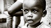 手臂僅比50元硬幣粗！全球超過2.32億兒童營養不良面臨死亡威脅