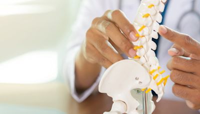 First patients treated in Bone Biologics spinal fusion trial