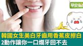 韓國女生美白牙齒用香蕉皮「擦白」？2動作讓你一口爛牙回不去