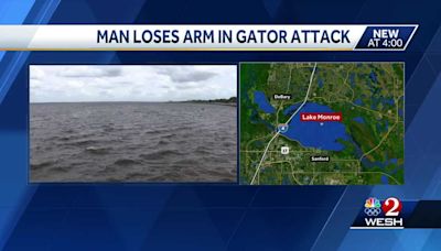 Man has arm amputated after gator attack at Seminole County lake