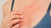 Itchy Nipples? Here Are 9 Potential Causes