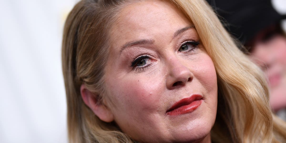 Christina Applegate Reveals ‘The Only Plastic Surgery’ She’s Had, And It’s Heartbreaking