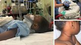 Five-year-old girl rushed to ICU after being strangled by jump rope in freak accident at summer camp