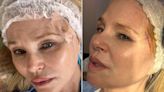 Celebs Who Have Had Skin Cancer — and What They Do Now to Prevent Recurrence