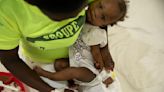 UN: Children in Haiti hit by cholera as malnutrition rises