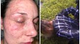 Police In Texas Held Woman's Face Down To Fire Ants, Federal Lawsuit Says