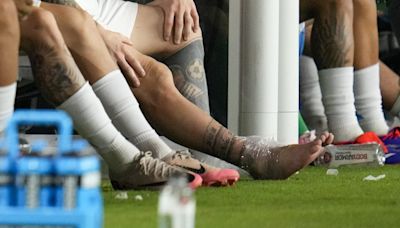Lesión de Messi en plena final de la Copa América 2024 causó sensación por el tamaño de su tobillo - El Diario NY