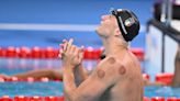 Olympics 2024: What is cupping and why do swimmers have red circles on their skin?
