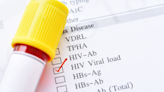 Persistent low-level viraemia raises the risk of serious non-AIDS events