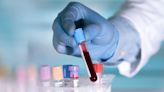 Blood tests for dementia could become the gold standard for diagnosis