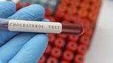 Why early cholesterol testing is important ? - News Today | First with the news