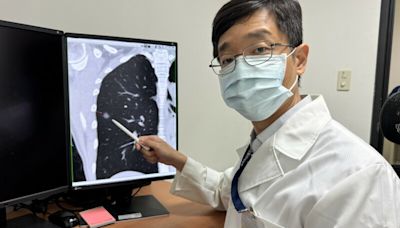 47歲女不抽菸、有家族病史 篩檢揪出肺腺癌！ | 生活 | Newtalk新聞