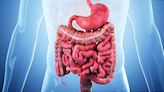 Prospects for Crohn's Relief Brighten With New Advancements