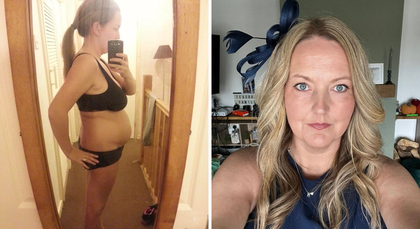 I looked seven months’ pregnant but it turned out to be cancer
