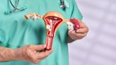 Síndrome de Rokitansky: la condición que provoca que las mujeres nazcan sin útero y canal vaginal