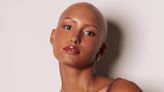 Modelo que nasceu careca desmistifica a alopecia: 'Tentava me esconder em uma peruca'