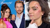 Derek Hough and Hayley Erbert Say They Are 'Both Okay' After 'Scary' Car Accident