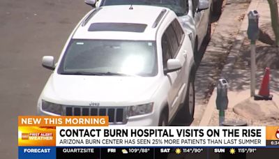 Arizona Burn Center sees 25% increase in contact burn patients this summer