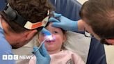 Raisin found in toddler's nose after three-month mystery