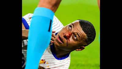 Euro 2024: France battle past tenacious Austria but Kylian Mbappe suffers facial injury