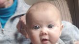 Baby's big eyes were secret sign of rare cause of blindness