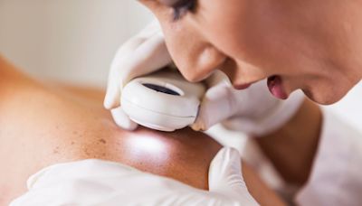 U.K. Tests World-First Personalized Skin Cancer Vaccine