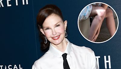 Ashley Judd Recalls Scary Leg Injury That Almost Led to Amputation: ‘I Am Profoundly Grateful’